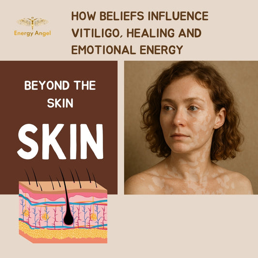 Beyond the Skin: How Beliefs Influence Vitiligo, Healing, and Emotional Energy