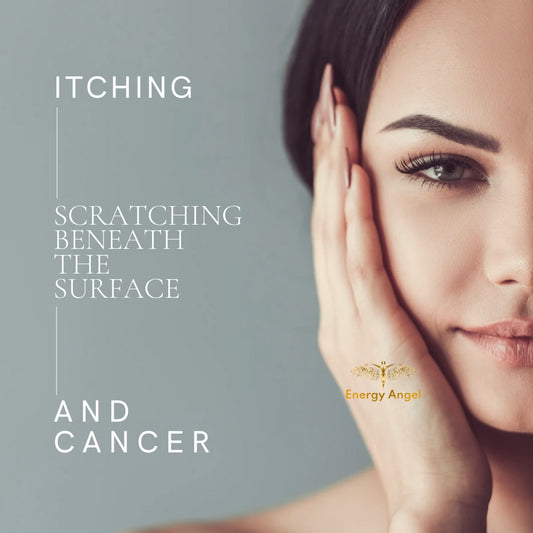 Scratching Beneath the Surface: Itching - a Common and Widespread Complaint - and Cancer